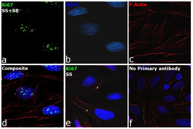 1 ML KI67 POLYCLONAL RABBIT IGG ANTIBODY