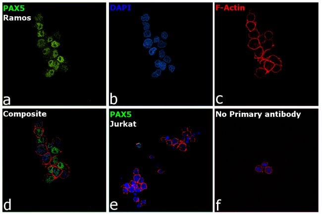1 ML PAX5 Rabbit polyclonal antibody IgG