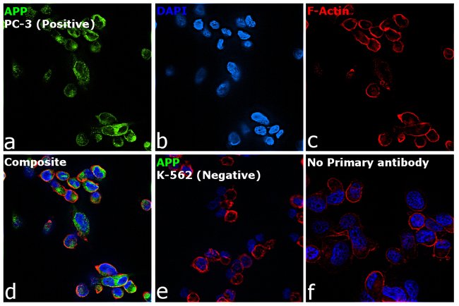 AMYLOID PRECURSOR PROTEIN