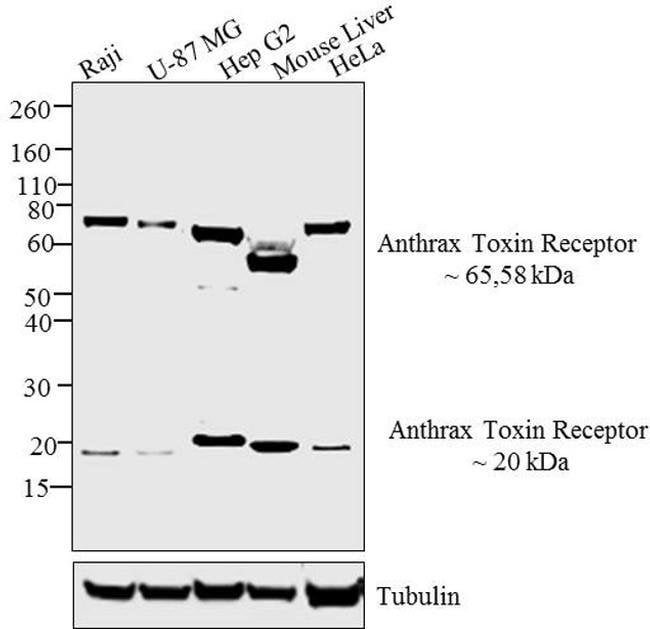 ANTHRAX TOXIN RECEPTOR