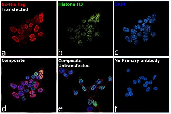 6X-HIS EPITOPE TAG