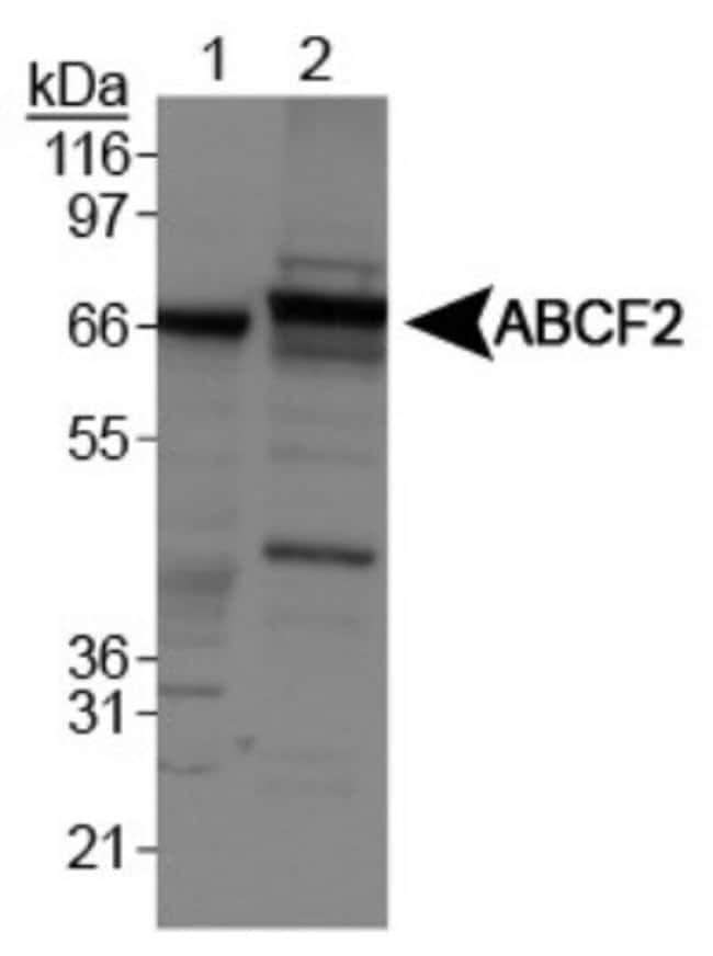 ABCF2