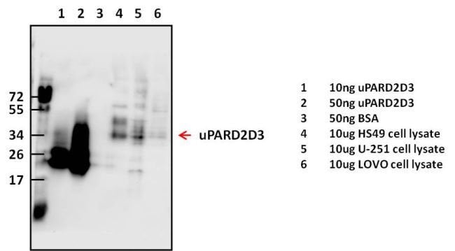 uPAR Polyclonal Antibody