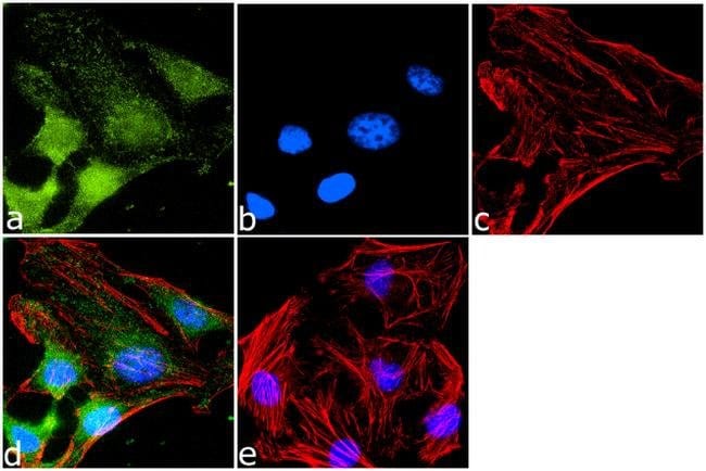 100 UL POLYCLONAL ANTIBODY, CXC CHEMOKIN