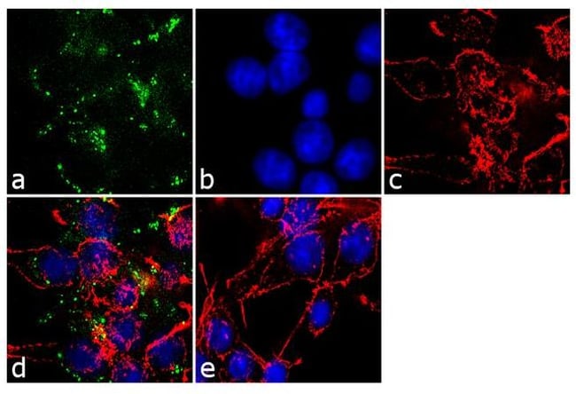 ANTI-AGTR2 TYPE-2 ANGIOTENSIN II RECEPTO