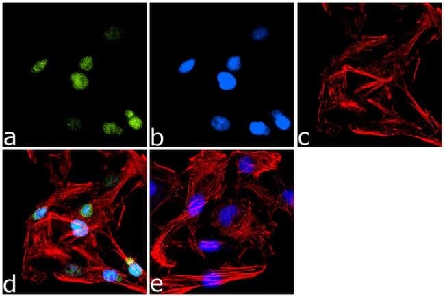 100 UG POLYCLONAL ANTIBODY, HOST RABBIT,