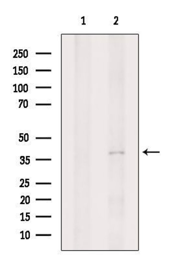 100UG P2Y11 Polyclonal Antibody