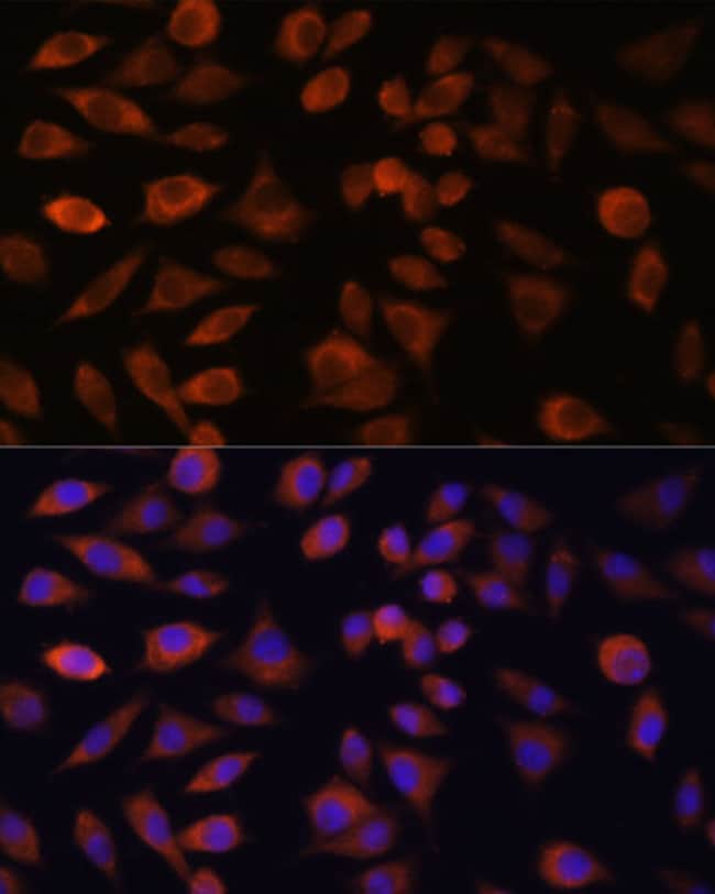 100 UL TRIM47 ANTIBODY