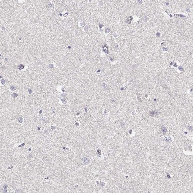 100 UL GPR174 ANTIBODY