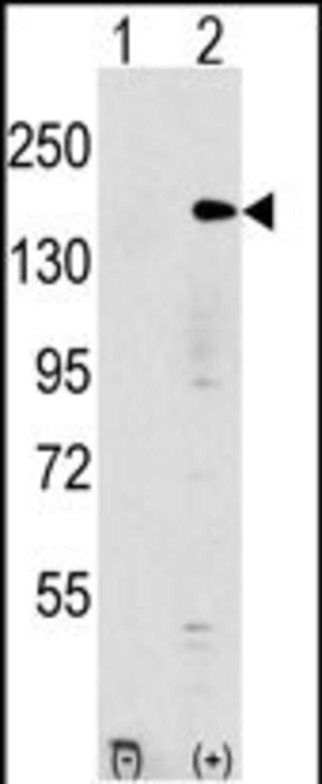 ANTI-EHMT1, 0,1 MG