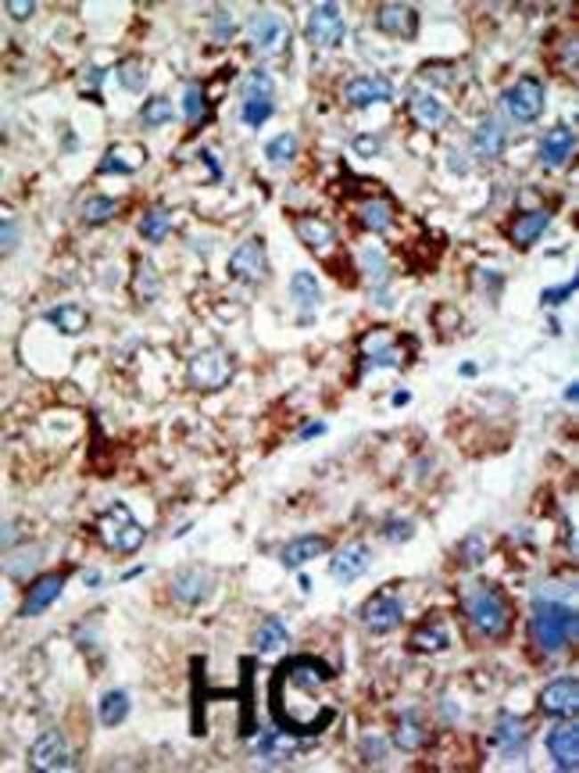 ANTI-USP21, 0,1 MG