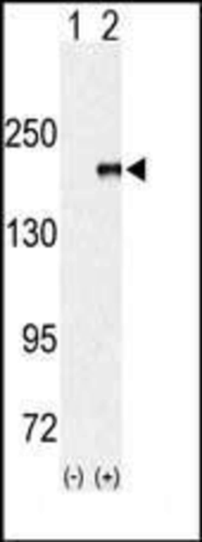 ANTI-EHMT1, 0,1mg .