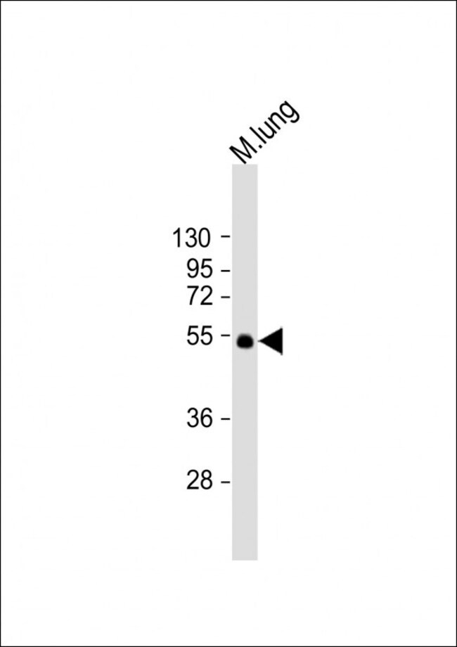 ANTI-ENT1, 0,1mg .