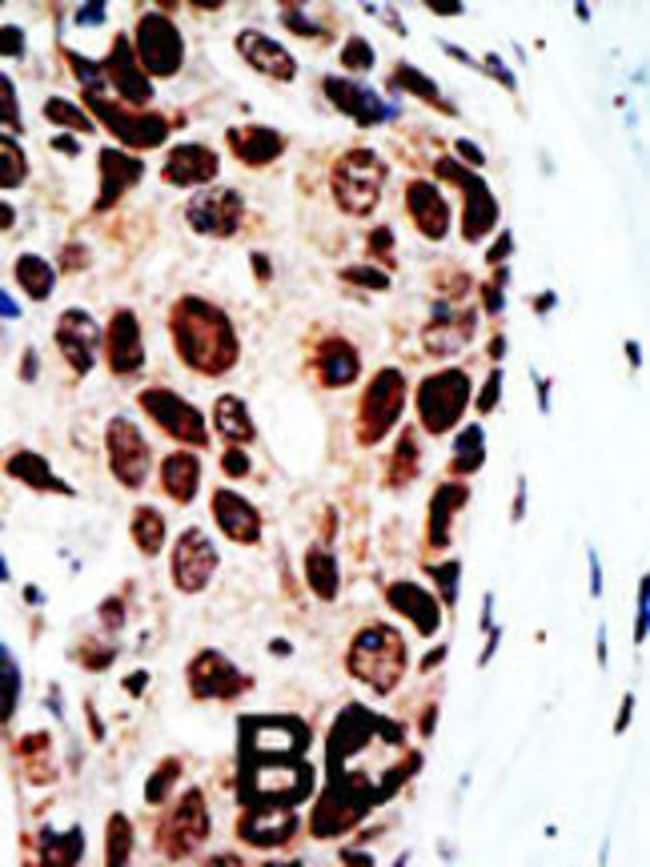 ANTI-HDAC9, 0,1 MG