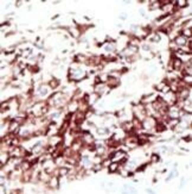ANTI-HDAC11, 0,1mg .