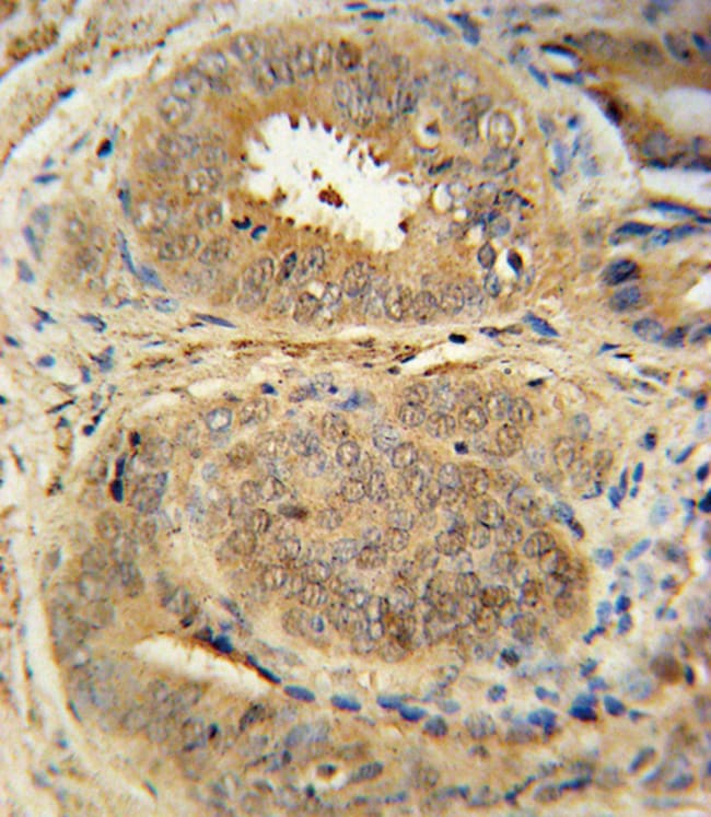 ANTI-MDM2