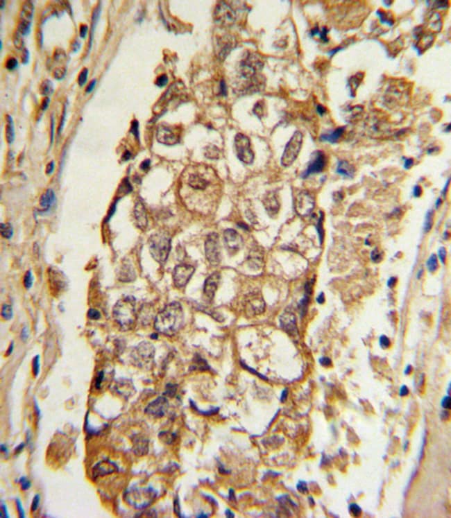 ANTI-MCL1, 0,1 MG