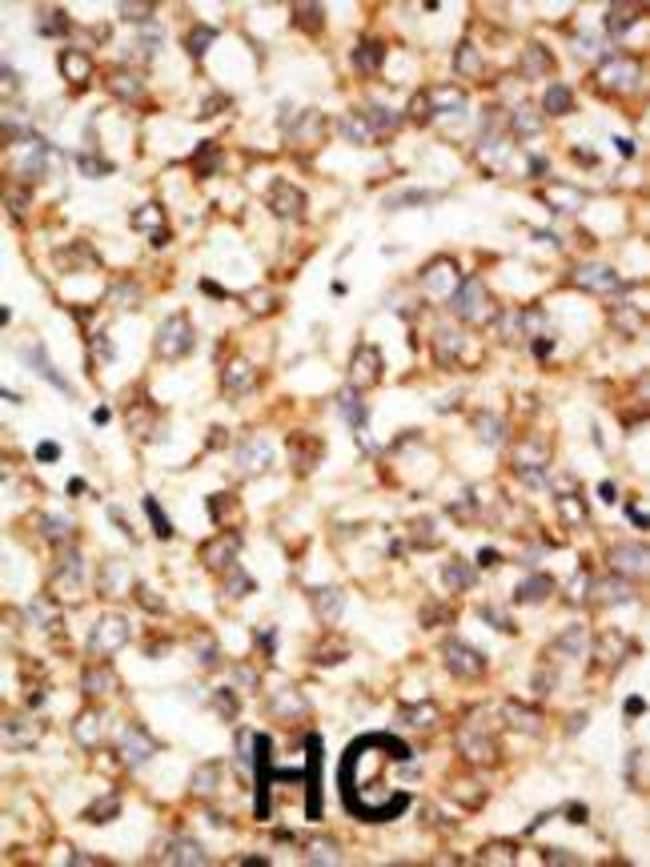 ANTI-APOBEC1, 0,1 MG