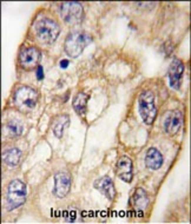ANTI-CD8A, 0,1 MG
