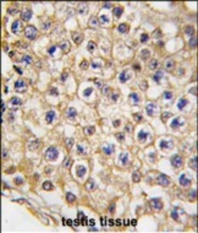 ANTI-TRPV3, 0,1 MG