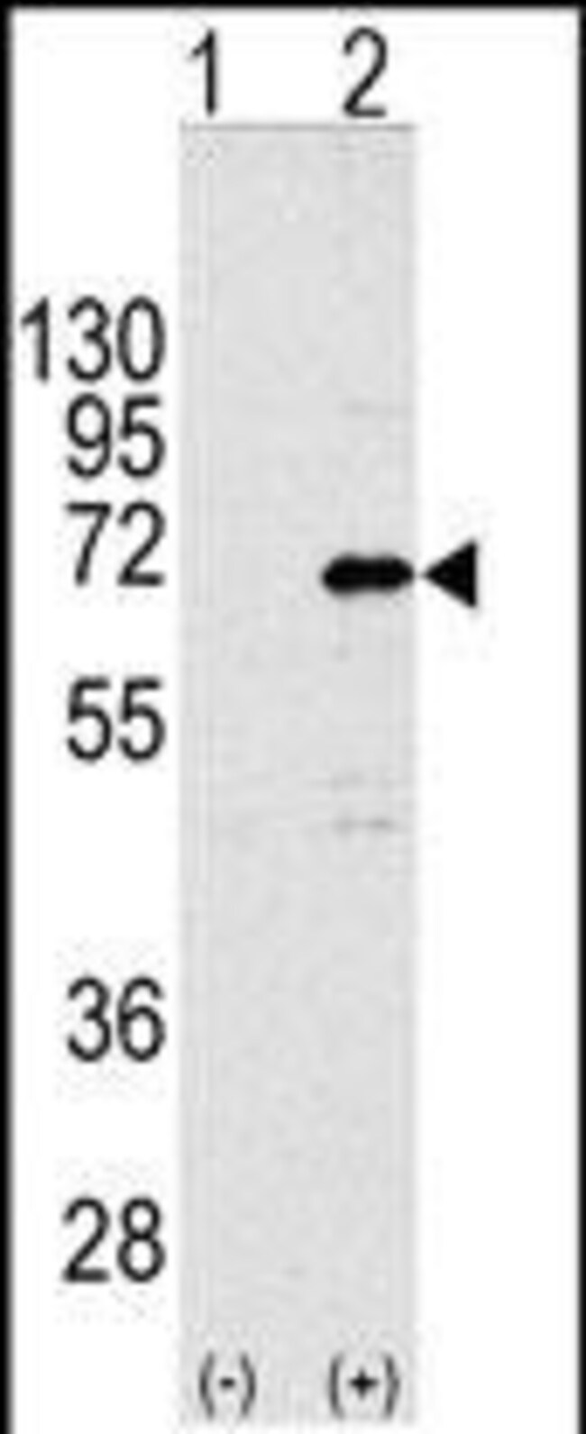 ANTI-CNOT4, 0,1 MG