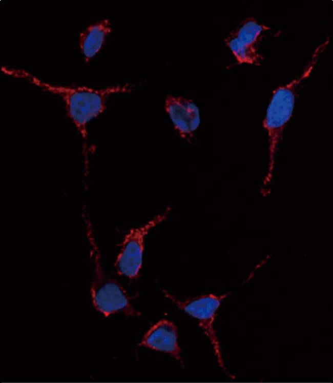 ANTI-ALDH1A1, 0,1mg .