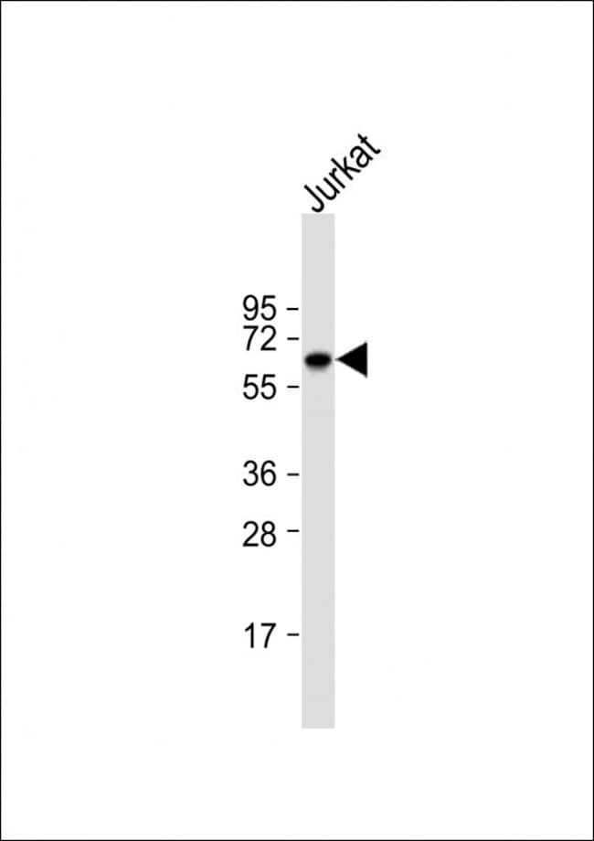 ANTI-GLUT2, 0,1 MG