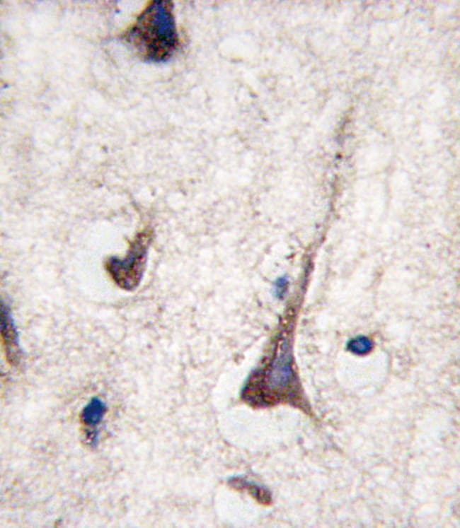 ANTI-CD3G, 0,1 MG