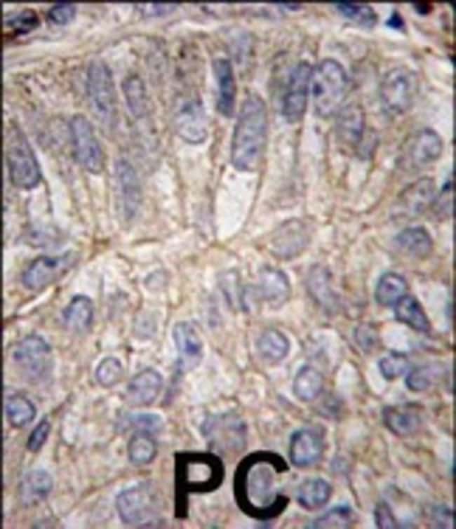 ANTI-CDH3, 0,1 MG