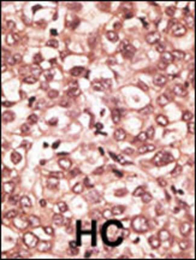 ANTI-TLR6, 0,1 MG