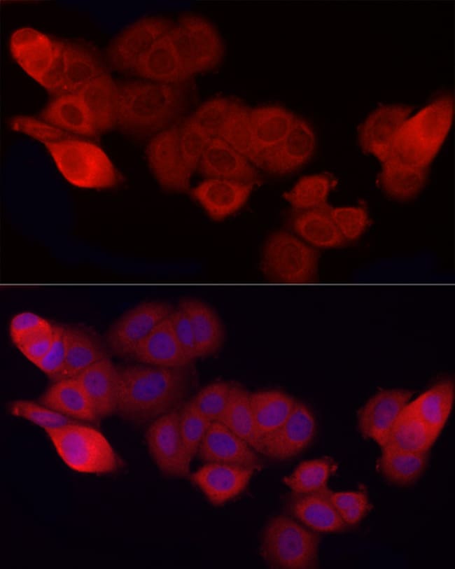 100ML CD47 Polyclonal Antibody