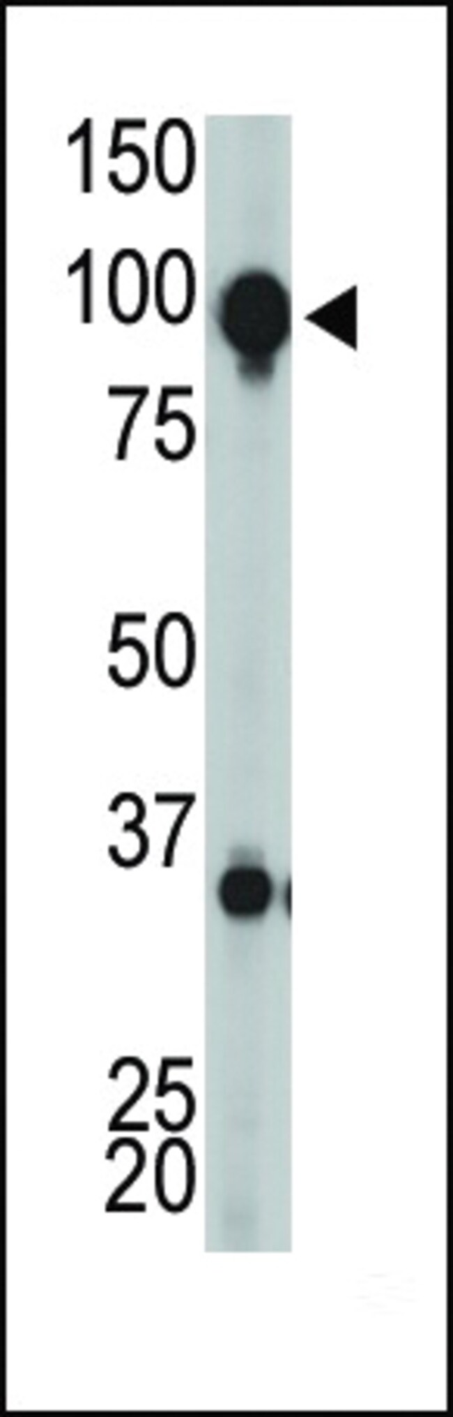 Anti-Metabotropic Glutamate Re 0.1 mg