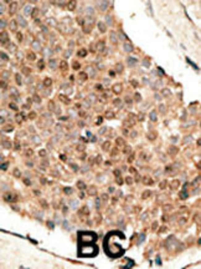 ANTI-BMP10, 0,1 MG