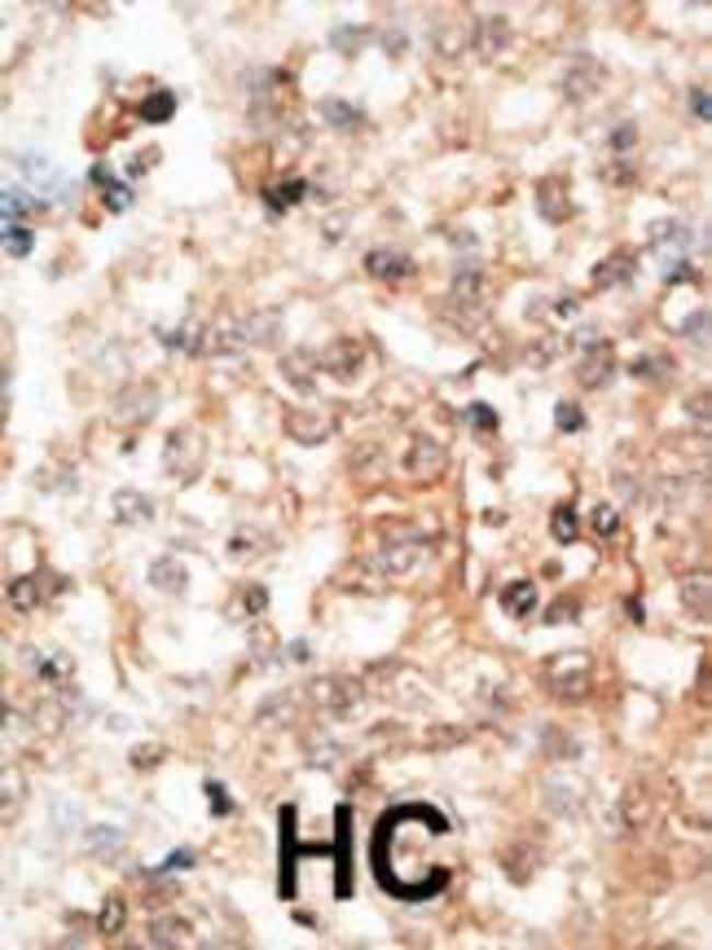 ANTI-OSTEOCALCIN, 0,1 MG