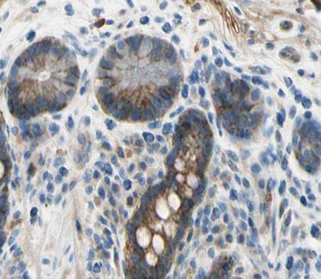 100UL APRIL ANTIBODY 100UL