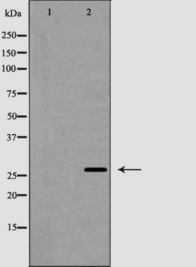 100UL APRIL ANTIBODY 100UL