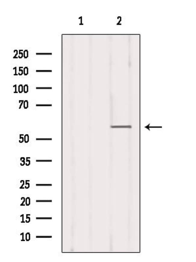 100UL B7-H3 ANTIBODY 100UL