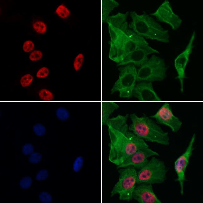 100UL ATF1 ANTIBODY 100UL
