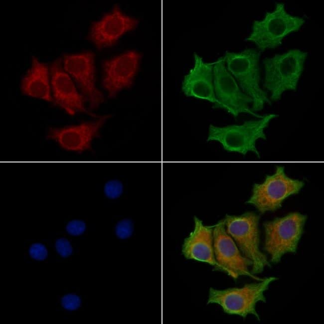 100UL ACVRL1 ANTIBODY 100UL