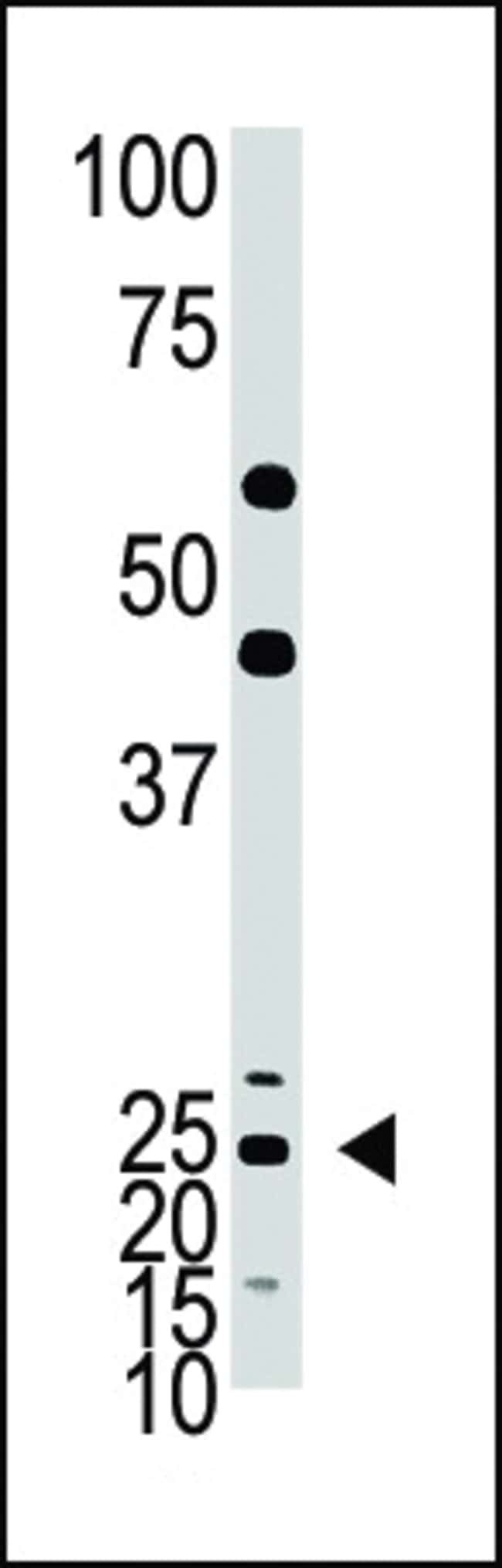ANTI-ASCL1, 0,1 MG