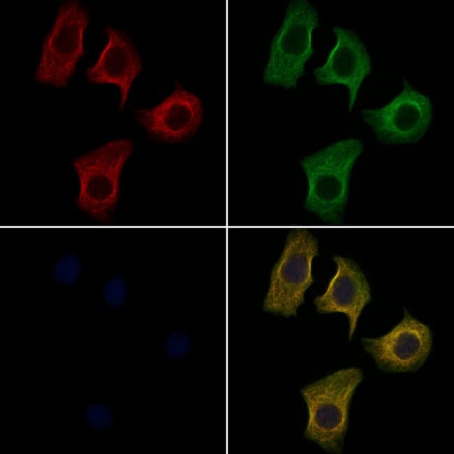 100UL APOA1BP ANTIBODY 100UL
