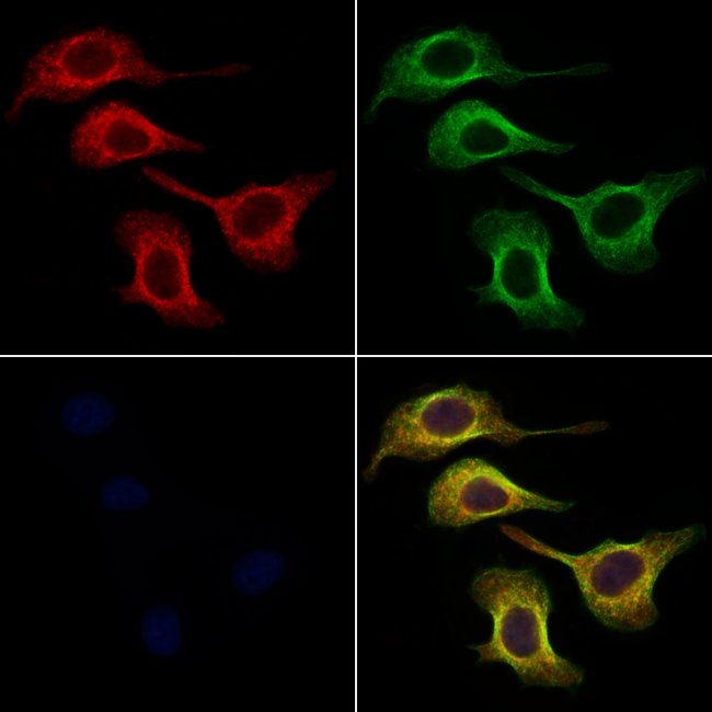 100UL ARYLSULFATASE A ANTIBODY 100UL