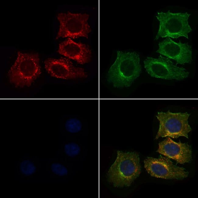 100UL ARP3 ANTIBODY 100UL