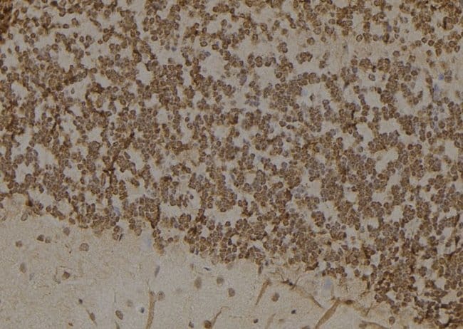 100UL AKR1B1 ANTIBODY 100UL