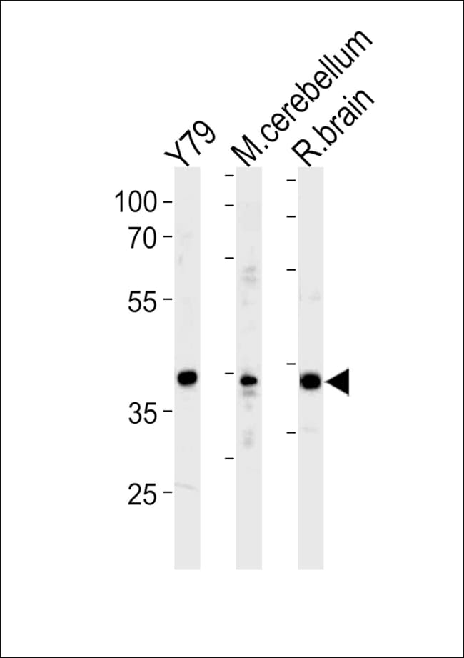 ANTI-NEUROD1, 0,1mg .