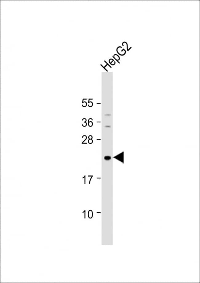 ANTI-NEUROG1, 0,1 MG