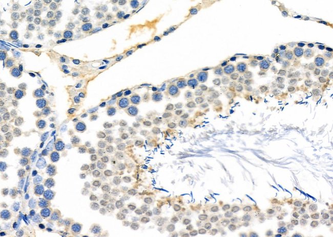 100UL ALPHA A CRYSTALLIN ANTIBODY 100UL