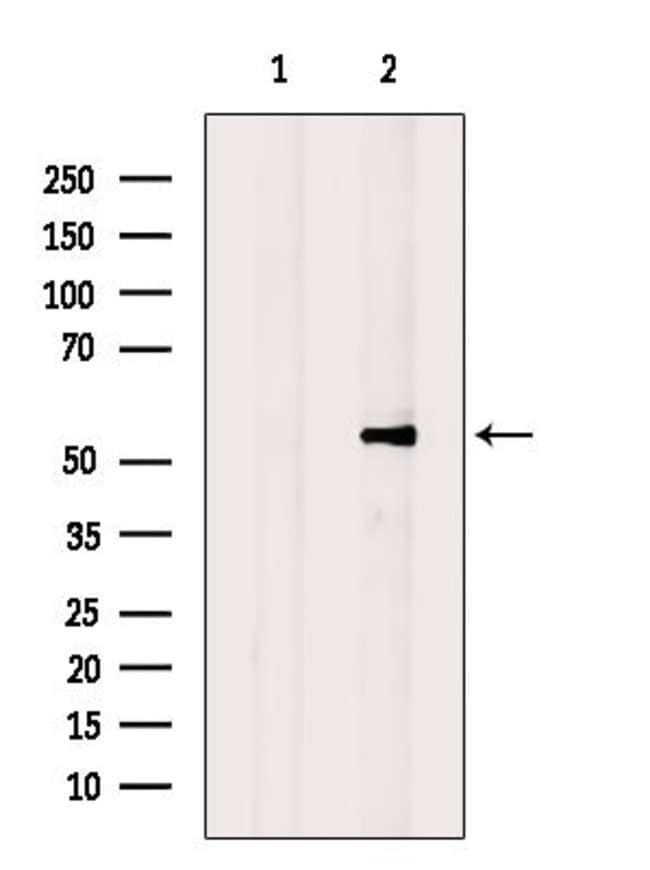 100UL ANNEXIN A11 ANTIBODY 100UL