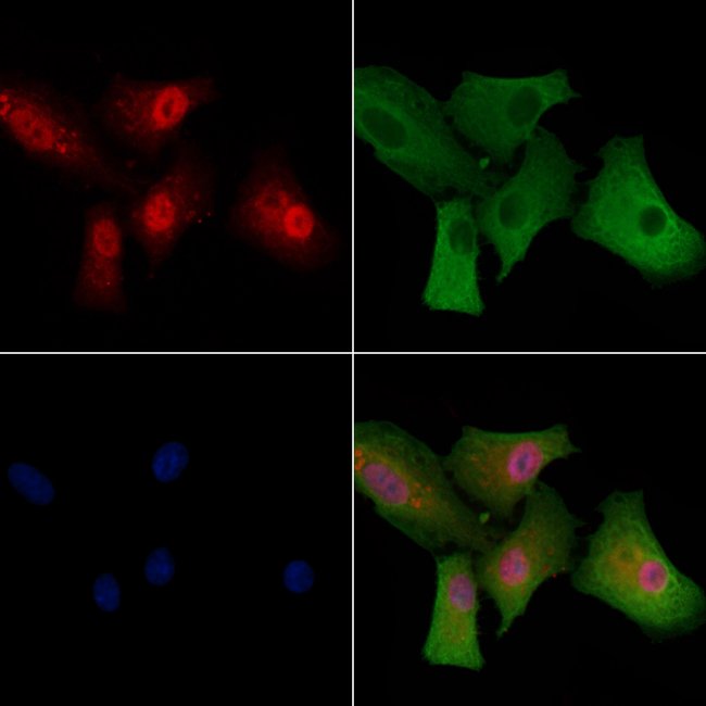 100UL ATAXIN 7 ANTIBODY 100UL