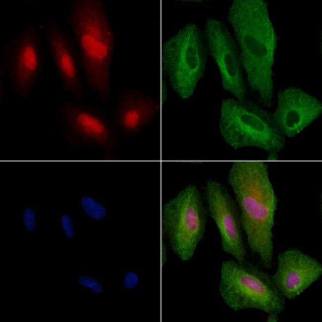 100UL ARHGAP25 ANTIBODY 100UL